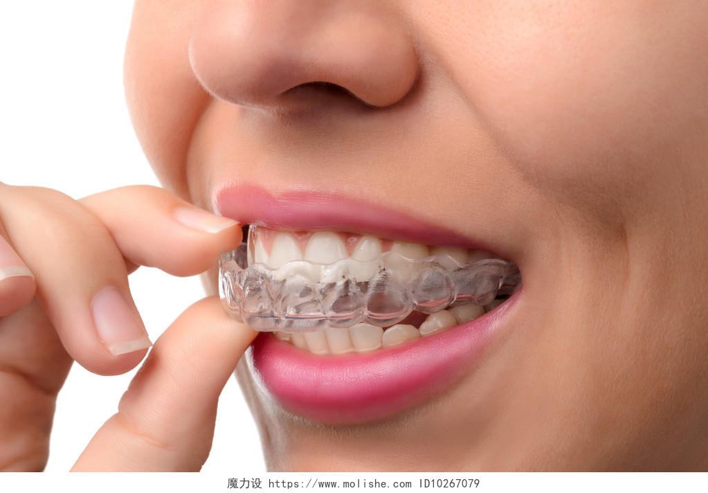 白色背景下人穿隐形牙套的正畸硅胶女教练牙齿矫正修复口腔牙齿口腔牙齿